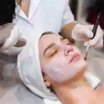 chemical peel, microneedling