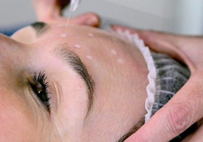 Anti Wrinkle Treatment, Injections, Ormskirk, Southport